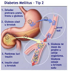 Tip2