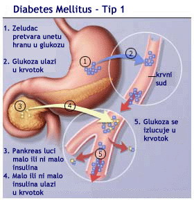 Tip1