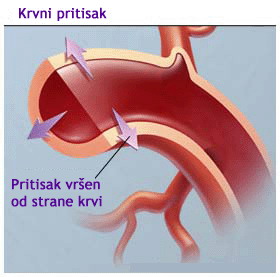 Pritisak