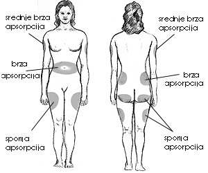 Mesta ubrizgavanja insulina